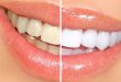 چگونه زردی دندان را از بین ببریم