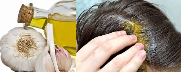درمان ریزش مو با سیر، خواص سیر برای مو و پوست