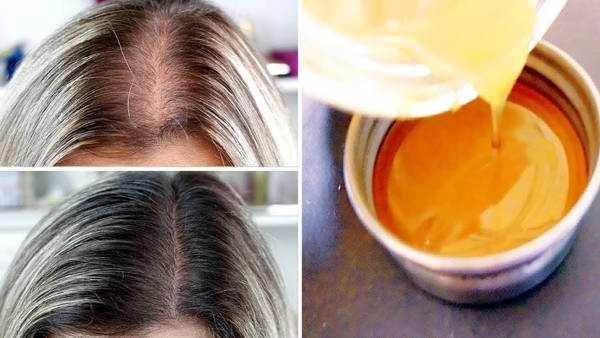 درمان ریزش مو با سیر، خواص سیر برای مو و پوست
