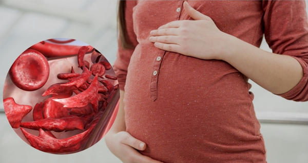 درمان کم خونی در بارداری